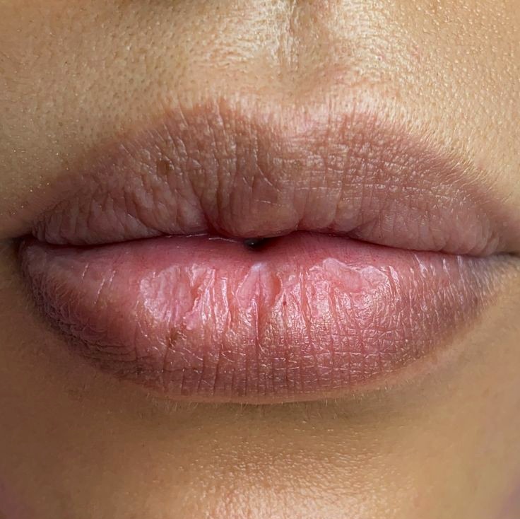 چگونه تیرگی لب‌ها را از بین ببریم؟