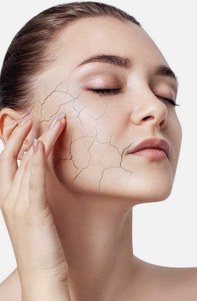 آیا پوست شما پس از شستشو خشک و کشیده می‌شود؟