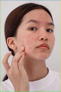 بهترین محصولات برای ترمیم سد دفاعی پوست