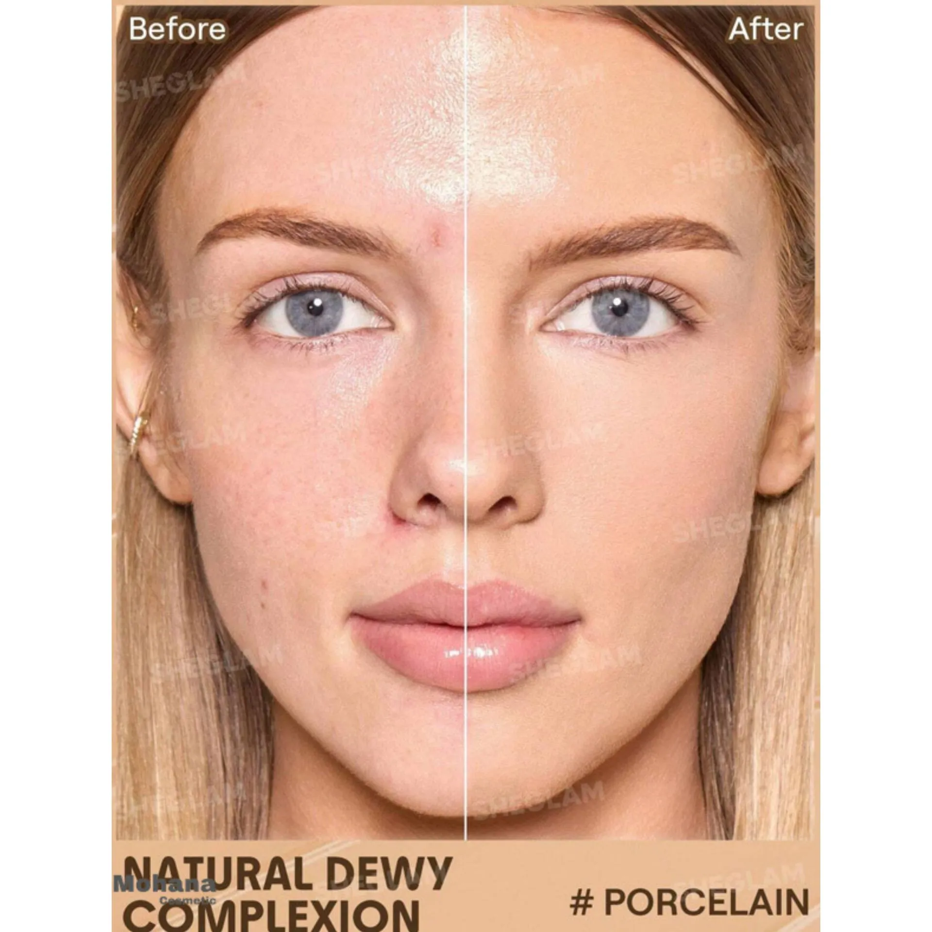 تینت پوست شیگلم